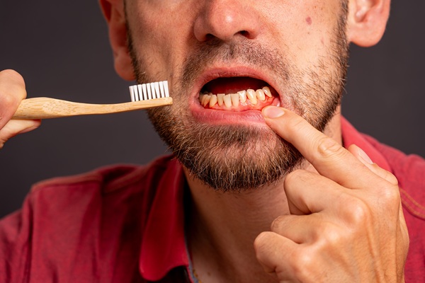 Can Periodontics Help Prevent Dental Emergencies?